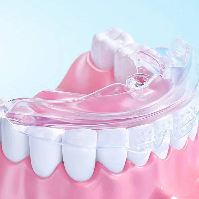 Pack de 3 Gouttières d'alignement dentaire