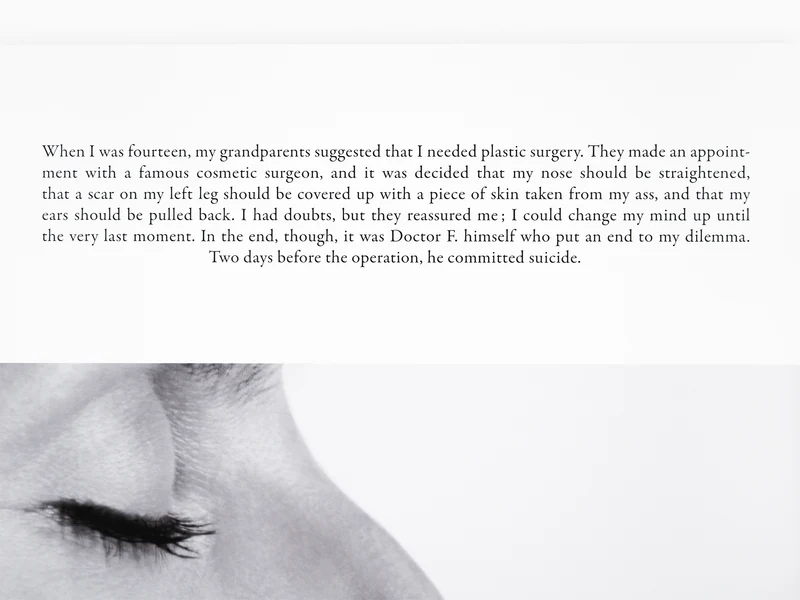 Sophie Calle - "La chirurgie esthétique"